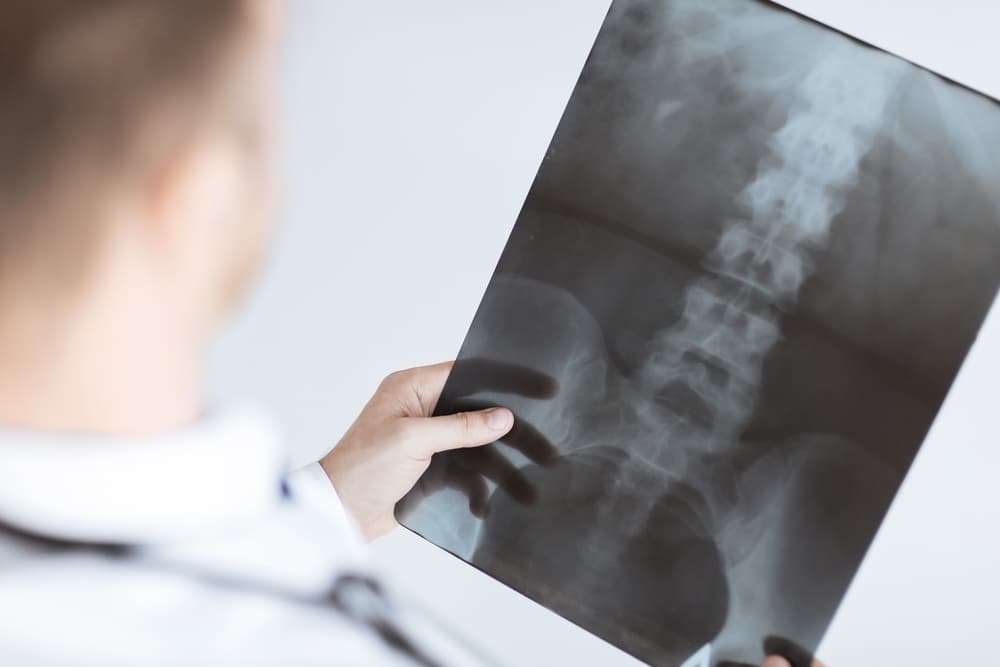 Male doctor holding x-ray report showing backbone.